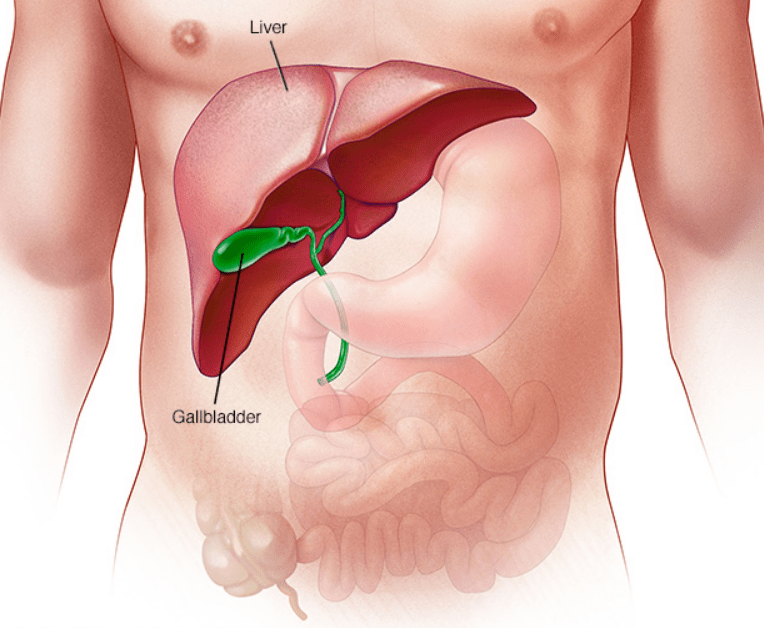 Laparoscopic Gallbladder Surgery - Dr. Kushankur Guha